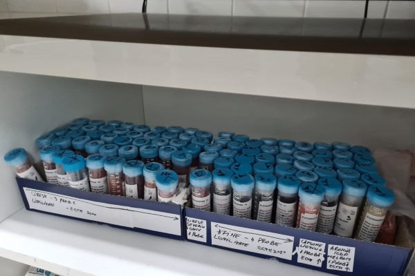 probe-fructe-liofilizate6E8EF9FB-F664-D554-D317-672839320094.jpg
