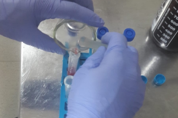 transfer-extract-vitamina-c-din-capsune-in-tub-de-centrifuga862A92DF-9B9D-7A79-F52B-20D869CC4760.jpg